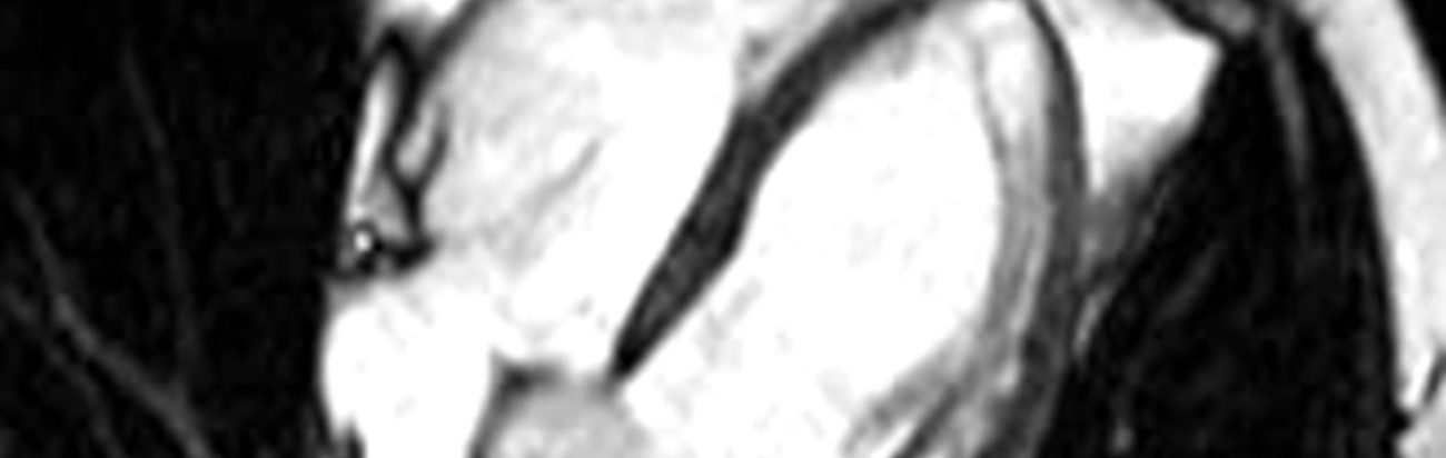 EinUntersuchungsbild der Kardiologie